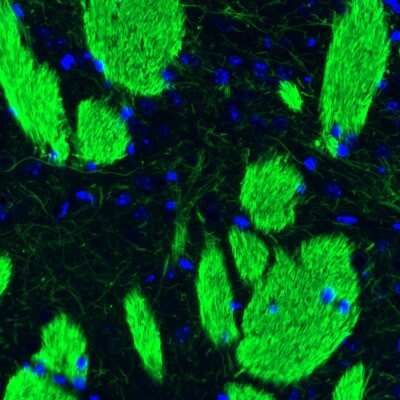 Immunohistochemistry: NF-L Antibody (CL4729) [NBP2-59061]
