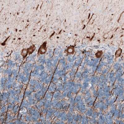 Immunohistochemistry-Paraffin: NF-L Antibody (CL4729) [NBP2-59061]