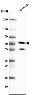 Western Blot: NF-L Antibody (CL4729) [NBP2-59061]