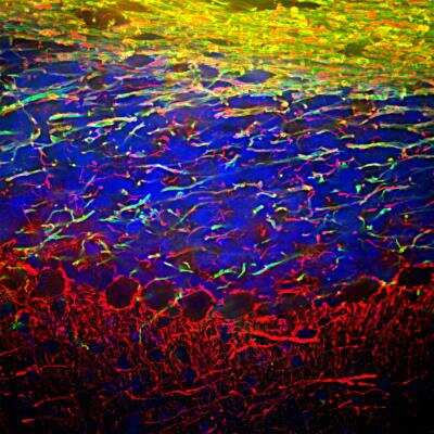 Immunocytochemistry/ Immunofluorescence: NF-L Antibody [NB300-131]