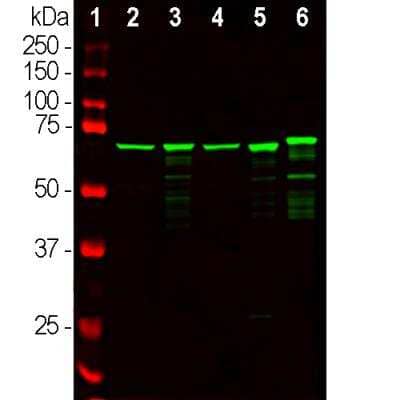 Western Blot: NF-L Antibody [NBP1-05219]