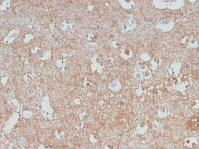 Immunohistochemistry-Paraffin: NF-L Antibody (NEFL/2983R) - Azide and BSA Free [NBP3-08553]