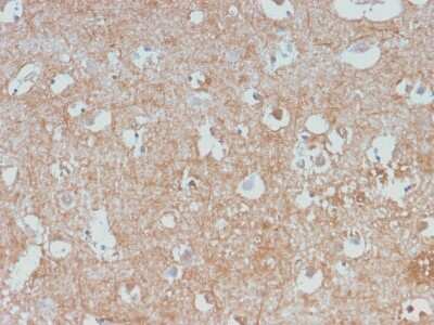 Immunohistochemistry-Paraffin: NF-L Antibody (NEFL/2983R) [NBP3-07407]