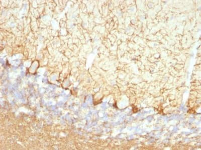 Immunohistochemistry-Paraffin: NF-L Antibody (NFL/736) [NBP2-44893]