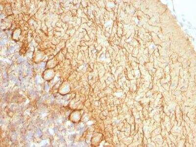 Immunohistochemistry-Paraffin: NF-L Antibody (NR-4) - IHC-Prediluted [NBP2-48292]