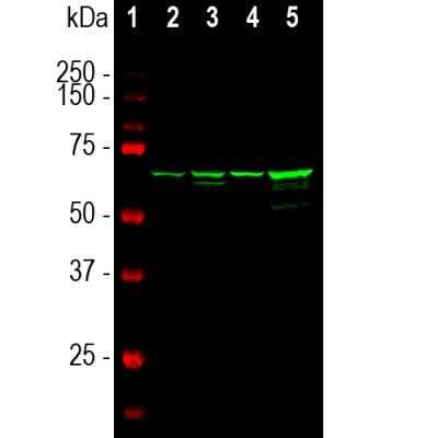 Western Blot: NF-L Antibody (7D1) [NBP2-50612]