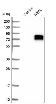 Western Blot: NF-L Antibody [NBP2-54669]
