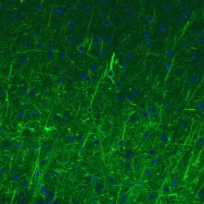 Immunohistochemistry: NF-M Antibody (CL2678) [NBP2-46616]