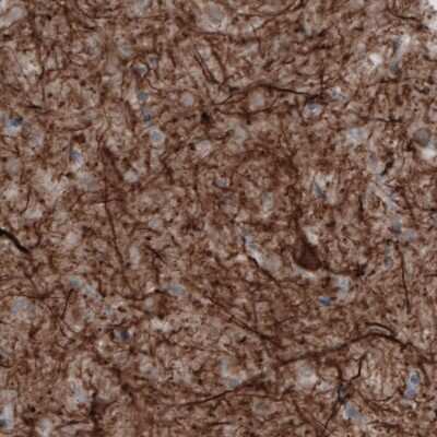 Immunohistochemistry: NF-M Antibody (CL2678) [NBP2-46616]