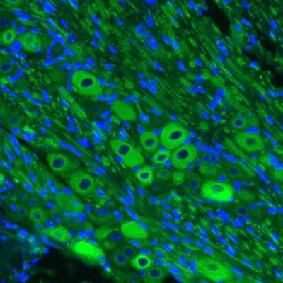 Immunohistochemistry: NF-M Antibody (CL2678) [NBP2-46616]