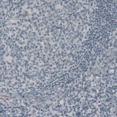 Immunohistochemistry: NF-M Antibody (CL2678) [NBP2-46616]