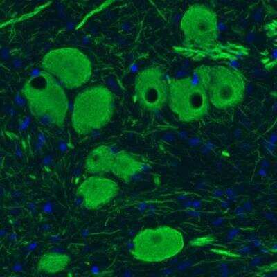 Immunohistochemistry-Paraffin: NF-M Antibody (CL2678) [NBP2-46616]