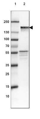 Western Blot: NF-M Antibody (CL2678) [NBP2-46616]