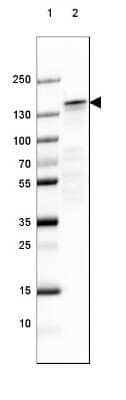 Western Blot: NF-M Antibody (CL2678) [NBP2-46616]