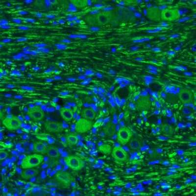 Immunohistochemistry: NF-M Antibody (CL2688) [NBP2-46618]