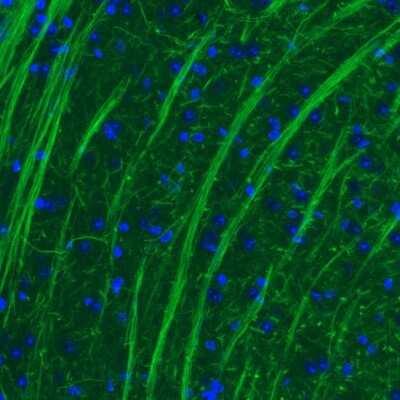 Immunohistochemistry: NF-M Antibody (CL2688) [NBP2-46618]