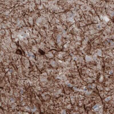 Immunohistochemistry: NF-M Antibody (CL2688) [NBP2-46618]