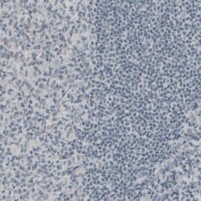 Immunohistochemistry: NF-M Antibody (CL2688) [NBP2-46618]