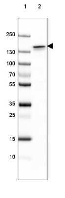 Western Blot: NF-M Antibody (CL2688) [NBP2-46618]