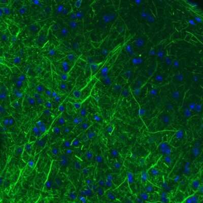 Immunohistochemistry: NF-M Antibody (CL2697) [NBP2-46619]