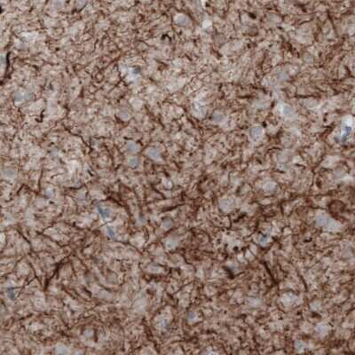 Immunohistochemistry: NF-M Antibody (CL2697) [NBP2-46619]
