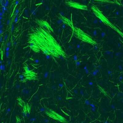 Immunohistochemistry: NF-M Antibody (CL2697) [NBP2-46619]