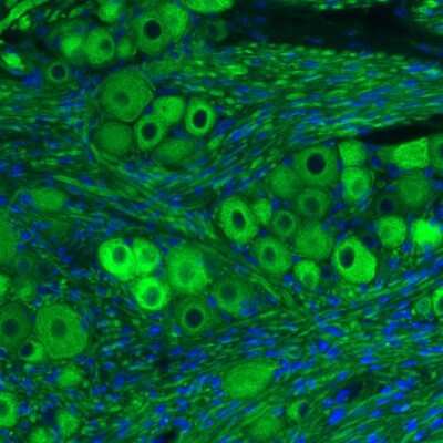 Immunohistochemistry: NF-M Antibody (CL2697) [NBP2-46619]