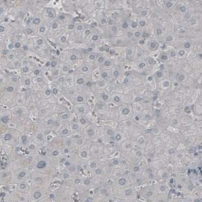 Immunohistochemistry: NF-M Antibody (CL2697) [NBP2-46619]