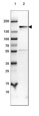 Western Blot: NF-M Antibody (CL2697) [NBP2-46619]
