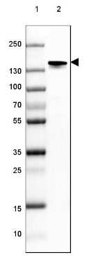 Western Blot: NF-M Antibody (CL2697) [NBP2-46619]