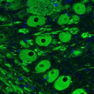 Immunohistochemistry: NF-M Antibody (CL2705) [NBP2-46625]