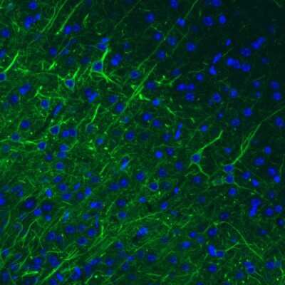 Immunohistochemistry: NF-M Antibody (CL2705) [NBP2-46625]
