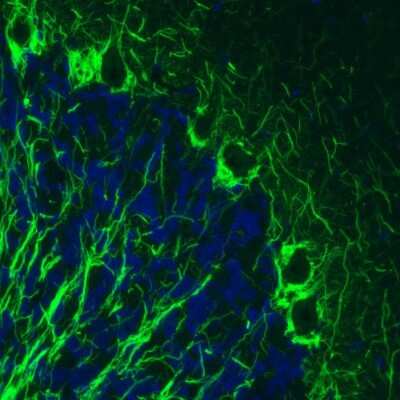 Immunohistochemistry: NF-M Antibody (CL2705) [NBP2-46625]