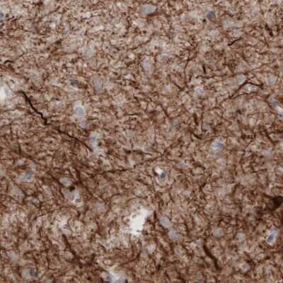 Immunohistochemistry: NF-M Antibody (CL2705) [NBP2-46625]