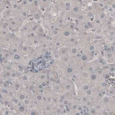 Immunohistochemistry: NF-M Antibody (CL2705) [NBP2-46625]