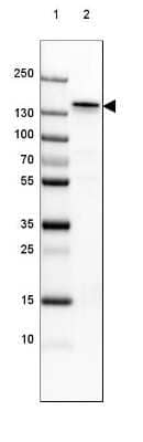 Western Blot: NF-M Antibody (CL2705) [NBP2-46625]