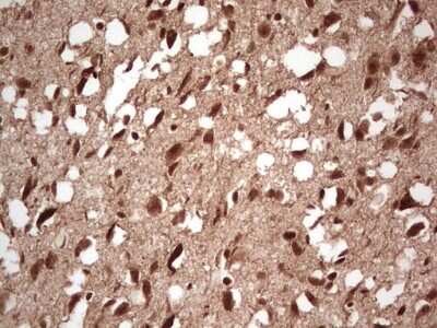 Immunohistochemistry: NF-M Antibody (OTI2G3) [NBP2-46139]