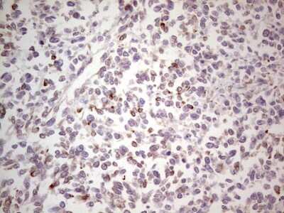 Immunohistochemistry: NF-M Antibody (OTI2G3) [NBP2-46139]