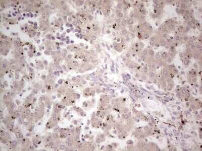 Immunohistochemistry: NF-M Antibody (OTI2G3) [NBP2-46139]