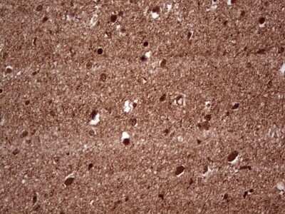 Immunohistochemistry: NF-M Antibody (OTI2G3) [NBP2-46139]