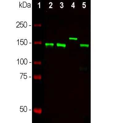 Western Blot: NF-M Antibody (3H11) [NB300-134]