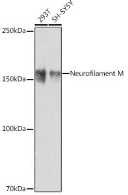 Western Blot: NF-M Antibody (5E0D2) [NBP3-15655]