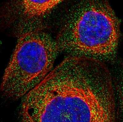 Immunocytochemistry/ Immunofluorescence: NF-M Antibody [NBP1-87753]