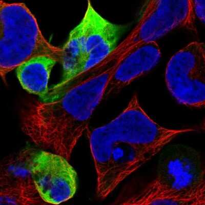 Immunocytochemistry/ Immunofluorescence: NF-M Antibody [NBP1-87753]