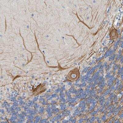 Immunohistochemistry-Paraffin: NF-M Antibody [NBP1-87753]