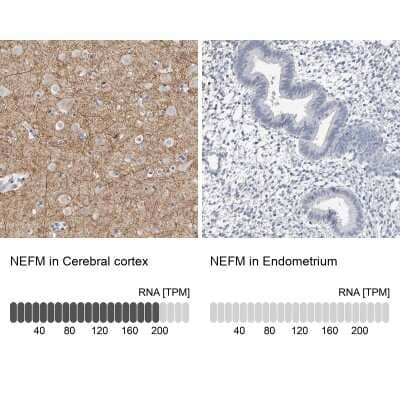 Immunohistochemistry-Paraffin: NF-M Antibody [NBP1-87753]