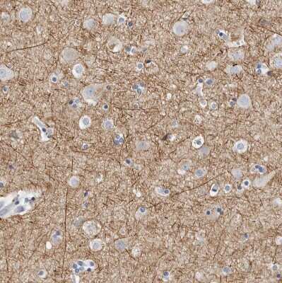 Immunohistochemistry-Paraffin: NF-M Antibody [NBP1-87753]