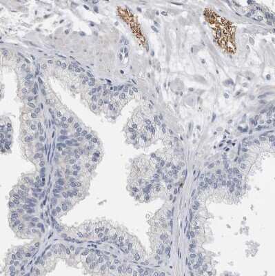 Immunohistochemistry-Paraffin: NF-M Antibody [NBP1-87753]