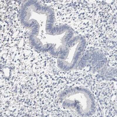 Immunohistochemistry-Paraffin: NF-M Antibody [NBP1-87753]