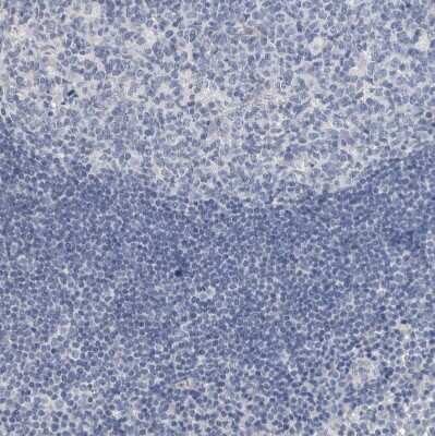 Immunohistochemistry-Paraffin: NF-M Antibody [NBP1-87753]